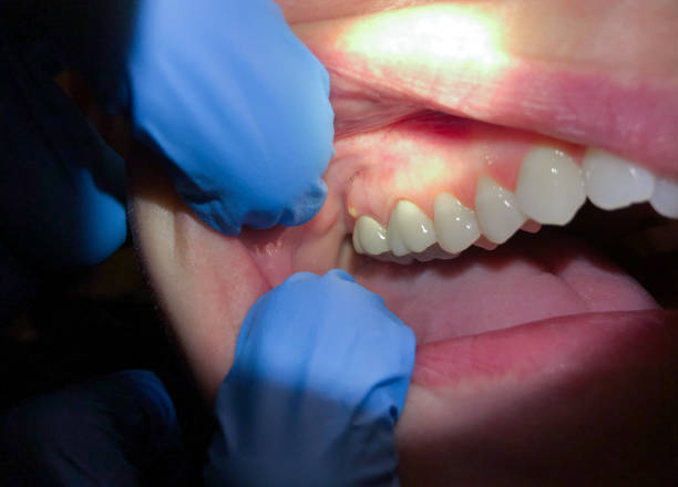 Best Pediatric Emergency Dentist in Wickes, AR