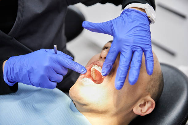 Best Emergency Dentist for Lost Fillings or Crowns in Wickes, AR
